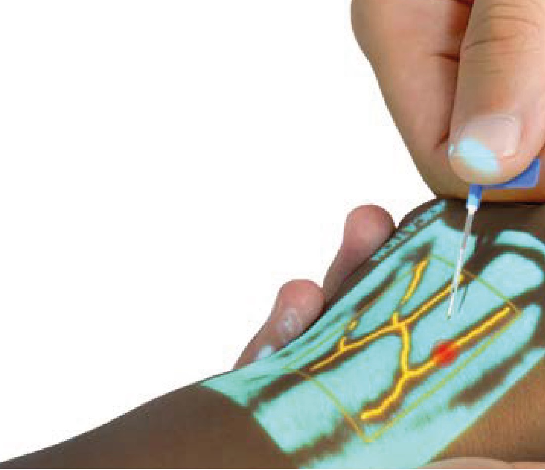Vein Finder